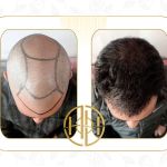 testimonial-img